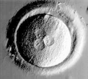 Développement embryonnaire FIV - fécondation anormale