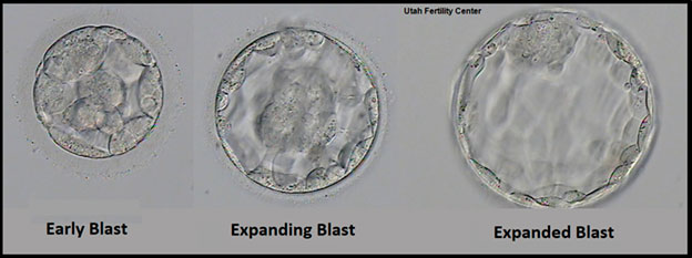 Développement embryonnaire FIV - stade blastocyste - jour 5