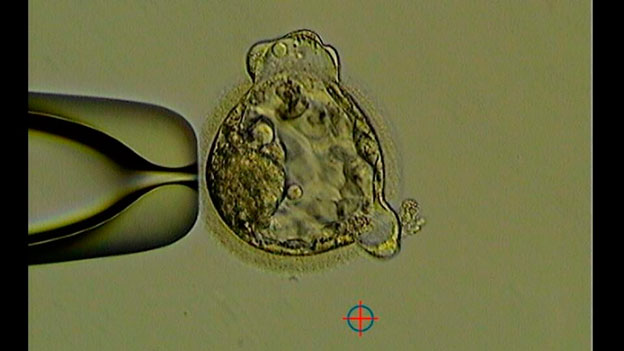 Développement d'embryons par FIV - Koala - photo
