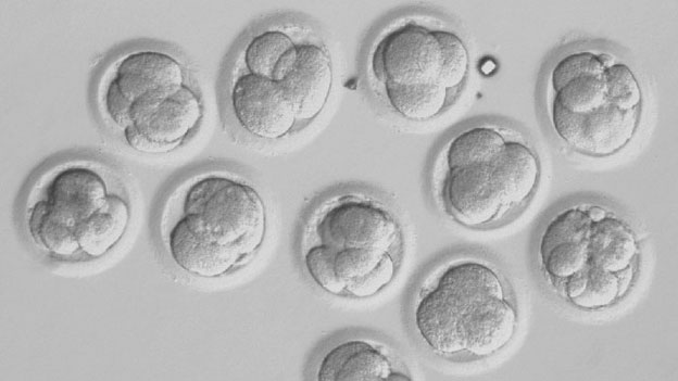 Développement d'embryons par FIV - aspect au microscope