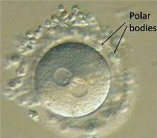 Corps polaires de développement d'embryons de FIV